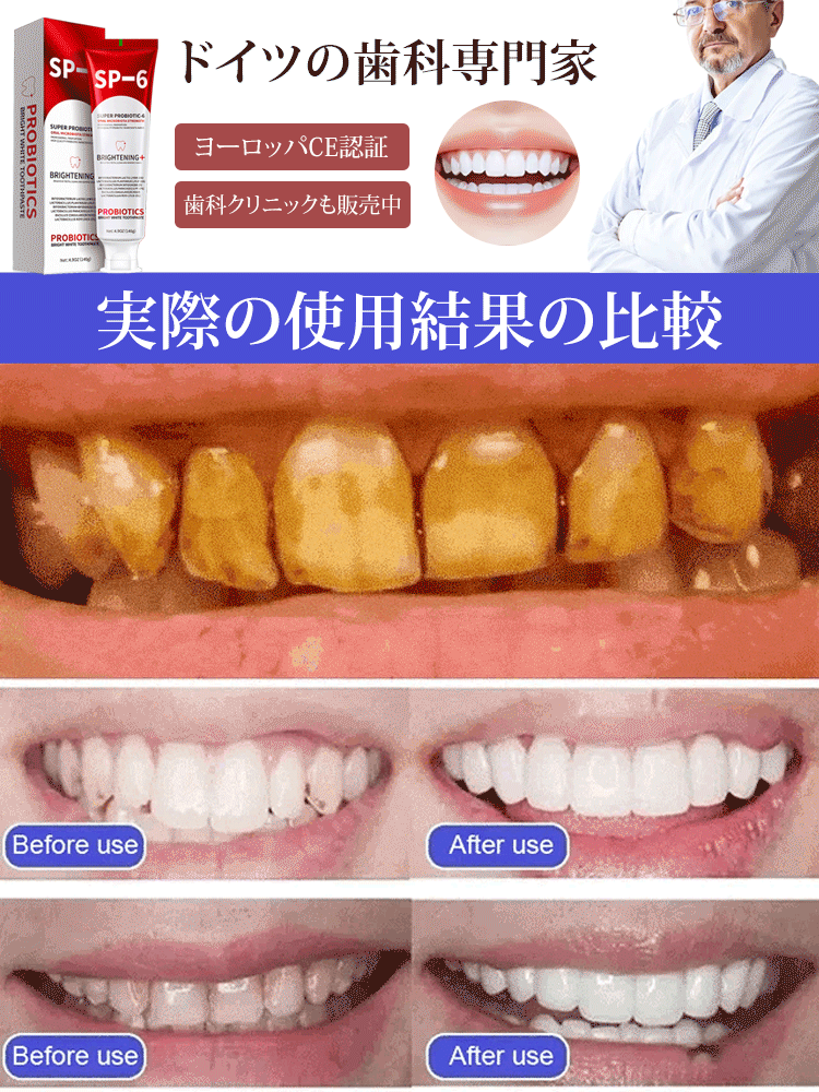 プロバイオティクスホワイトニング歯磨き粉